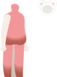 ハリニコゲボディ